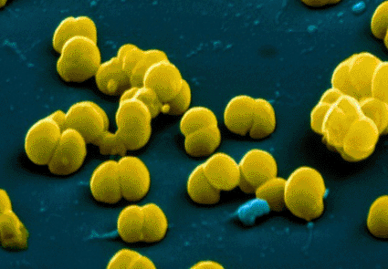 Image: Colored scanning electron micrograph (SEM) of Neisseria meningitidis bacteria, one of the causes of meningitis (photo courtesy the Eye of Science).